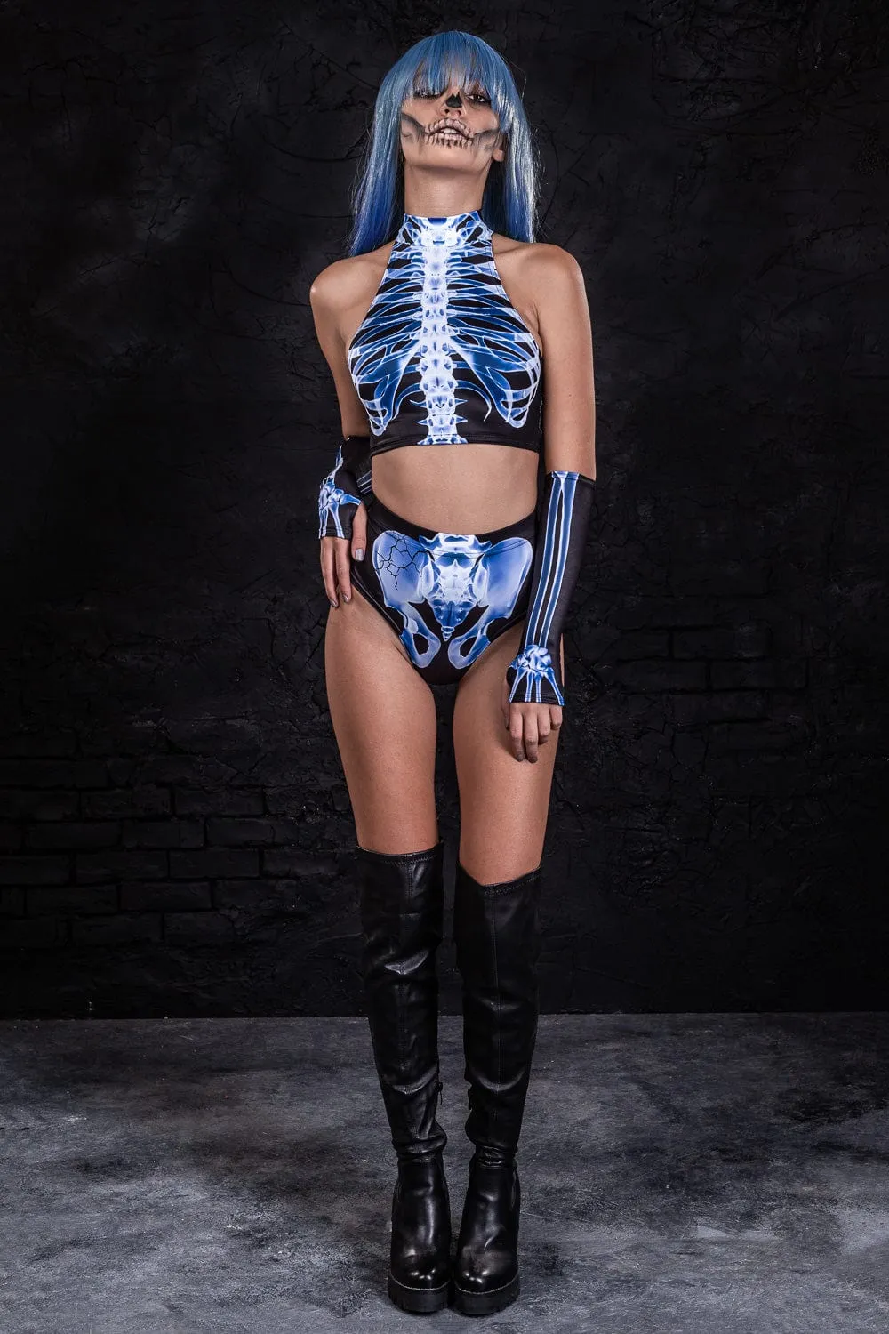 X-Ray Skeleton Fit Top